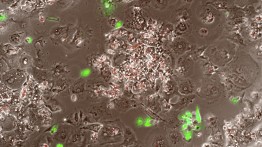 Human umbilical vein endothelial cells, in green, in co-culture with hepatocytes. Image courtesy of Osaze Udeagbala  